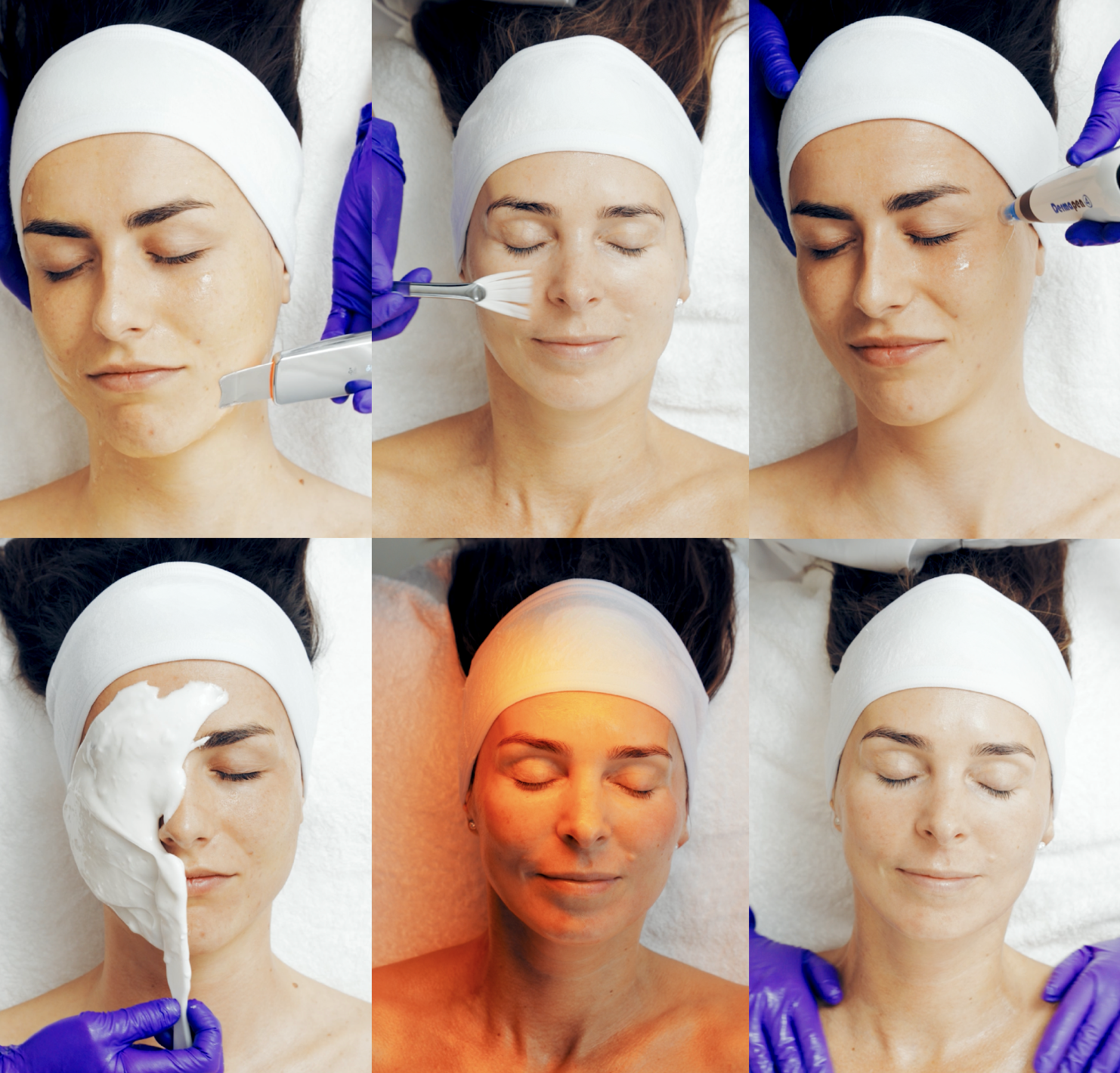 Longevity Cell Needling – Exclusief bij Prescription