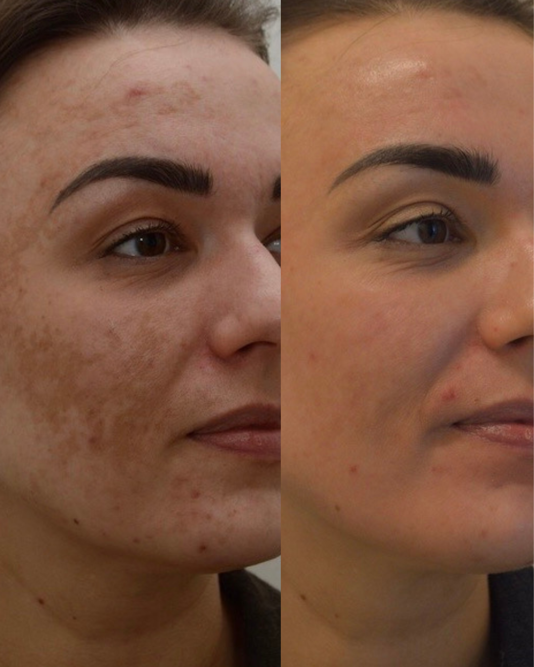 Before & afters